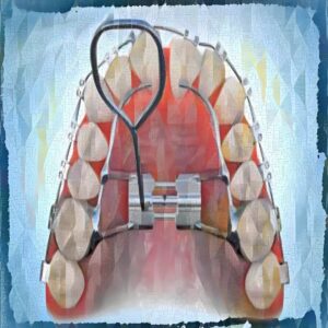 Negentropic Maxilla Masterwork - Sapien Medicine